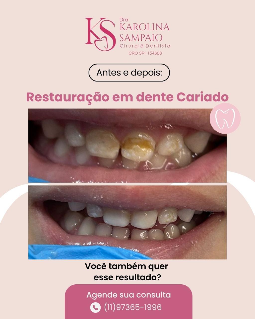 Resultado 7